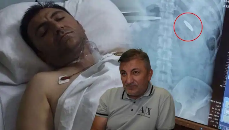15 Temmuz’un İzleri: Kurşun Yaraları ile Mücadele Eden Kahraman
